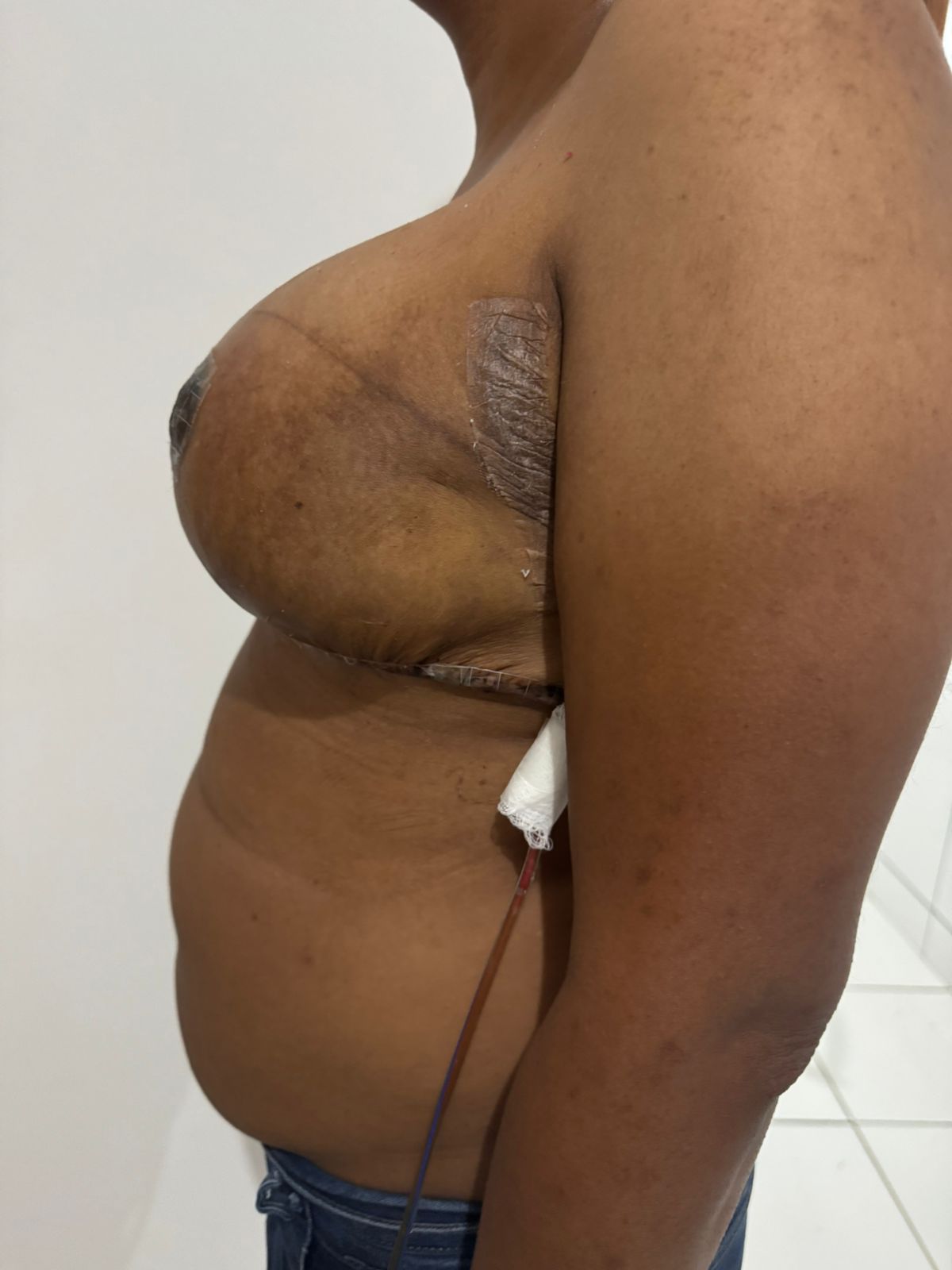 Imagem de depois do procedimento