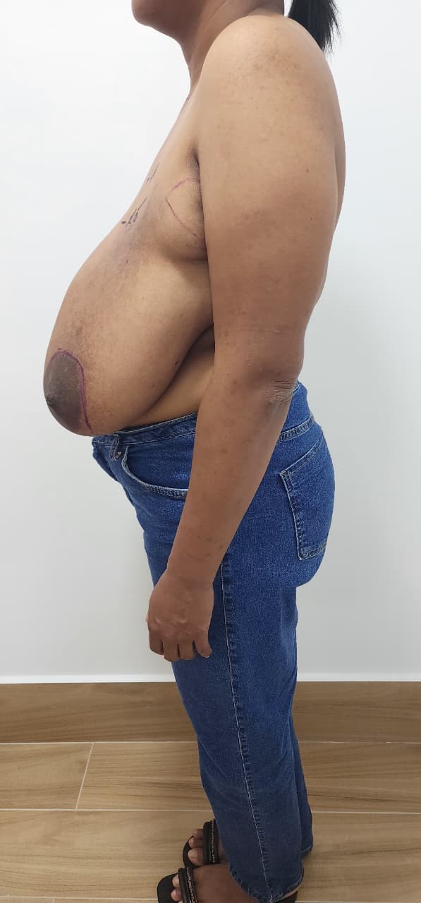 Imagem de antes do procedimento